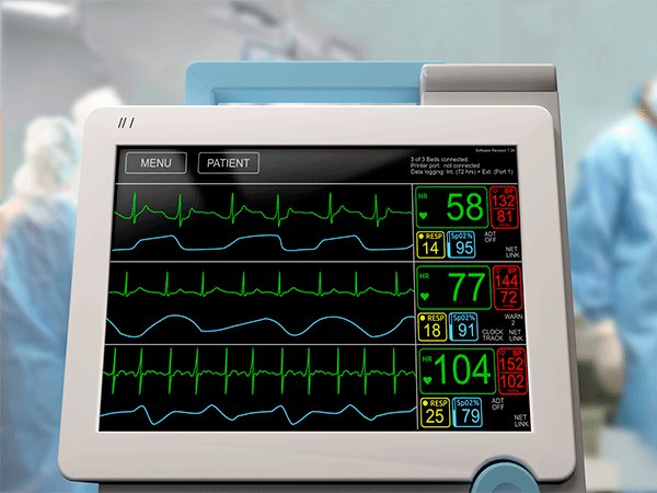  Monitores de uso médico